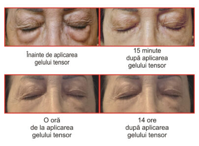 Gel tensor instant anticearcăn antirid - imagine 2