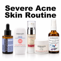 Severe Acne Skin Routine